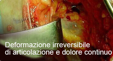 HONDRO SOL ACQUISTARE