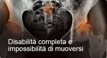 HONDRO SOL ACQUISTARE